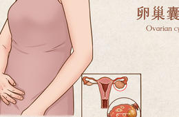 卵巢囊肿很大几率是这几种原因，请对号入座