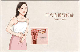 子宫腺肌病从何而来？和子宫内膜异位症是什么关系？
