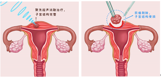 新冠之后，生育力又面临新的问题