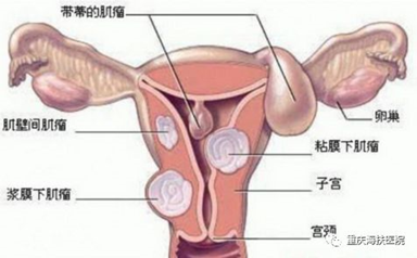 这样做手术，难怪台湾教授、印度妇科专家也来认真学习了……