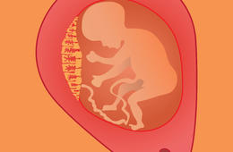 胎盤植入產檢時做彩超能看出來嗎
