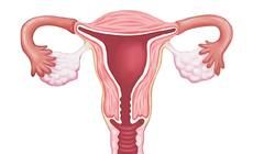 子宮內膜異位癥為什么會發生，多與這幾個因素有關