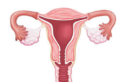 子宮內膜異位癥為什么會發生，多與這幾個因素有關