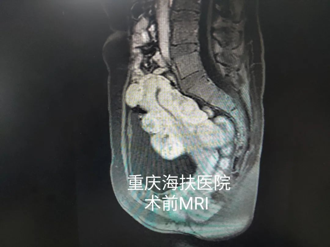 她分享：一个人的海扶之旅，收获满满