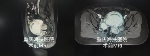 痛经15年，90后的她如何选择？