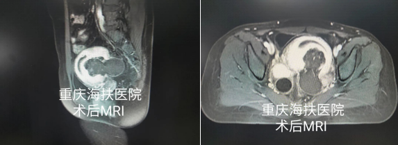 痛经15年，90后的她如何选择？