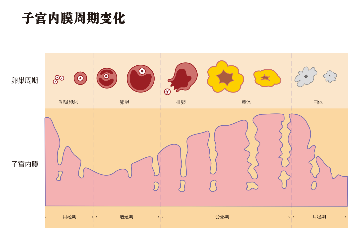 子宫内膜息肉和宫颈息肉有什么不同