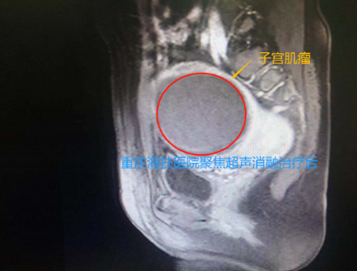 悠悠闺蜜情，暖心海扶行