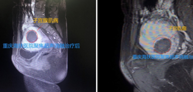 悠悠闺蜜情，暖心海扶行