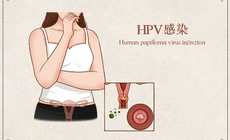 預防HPV感染，請做好這幾點