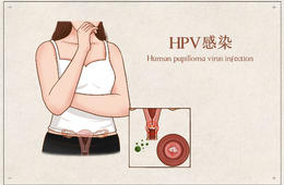 預防HPV感染，請做好這幾點