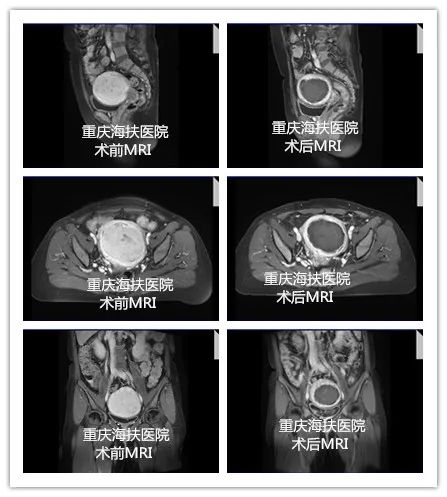 经历10分痛经与重度贫血后……