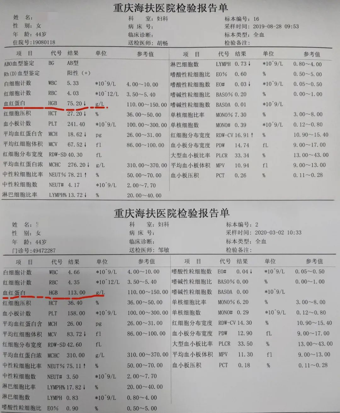 海扶刀®术后2年，不贫血、不痛经，肌瘤缩小90%