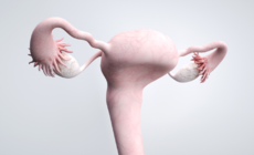 子宮闊韌帶肌瘤是什么原因導致的
