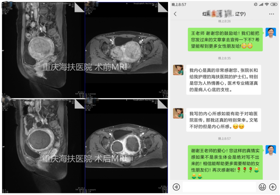 我的保宫之旅：温暖、感动与重生