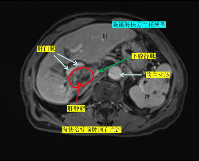 大医微课 大医微课