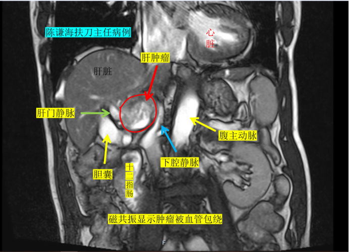 大医微课 大医微课