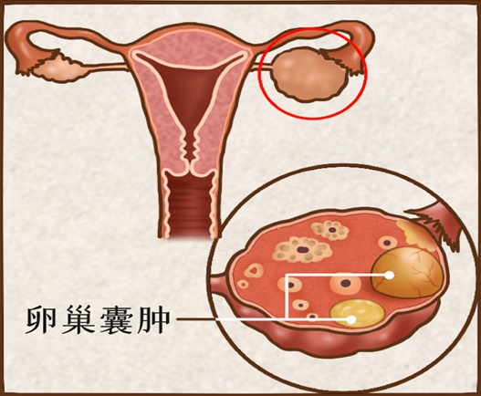 这几种疾病总爱青睐中老年女性