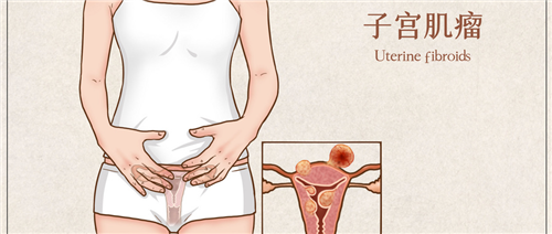 妇科主任建议：得子宫肌瘤该这样高效助孕！