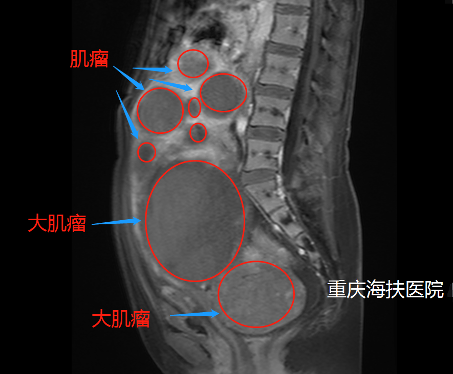 很不幸，我就是那五分之一