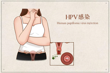 劝女性“远离”这四类男人！否则易感染HPV