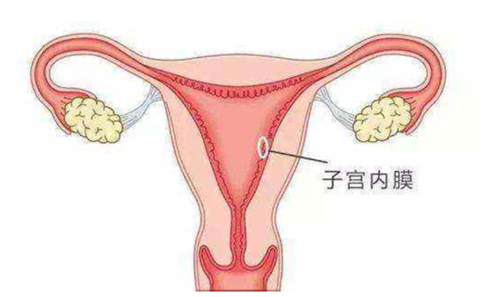 子宫内膜炎会不会影响怀孕？