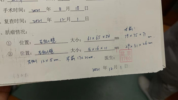 子宫肌瘤术后多久可以备孕，听听患者怎么说