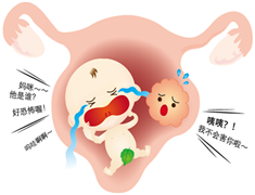 子宫肌瘤趣味小科普：什么情况下可能是得了子宫肌瘤?