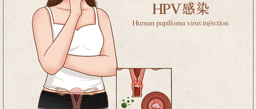 HPV不等于宫颈癌，别再为HPV过度恐慌！