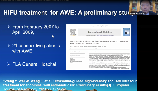 国际知名专家齐聚，探讨HIFU治疗内异症的最新进展