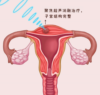 5·30全国科技工作者日——致敬聚焦超声消融领域科技工作者们