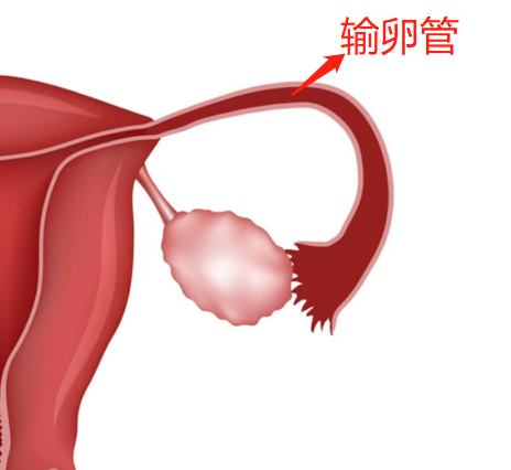 输卵管积水是怎么回事？