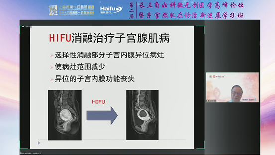 郎景和院士等大咖授课，第二届长三角妇科微无创医学高峰论坛顺利举行