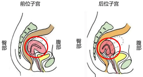 子宫前置和后置有什么区别？