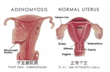 一位痛经女士的二胎奇遇记