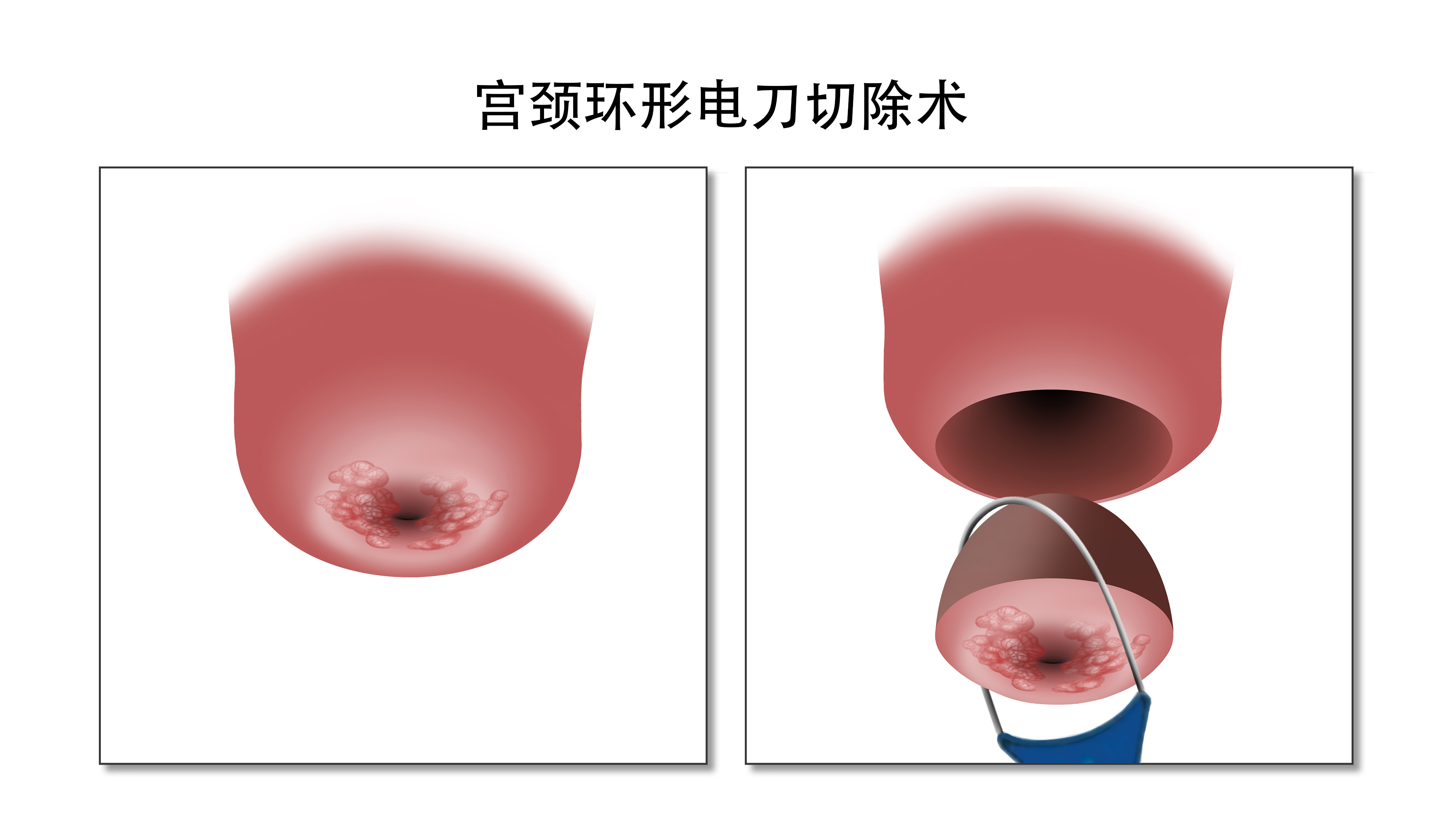 宫颈有什么作用？这三点一定要知道