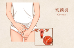 宫颈炎长期不管，会有什么影响？