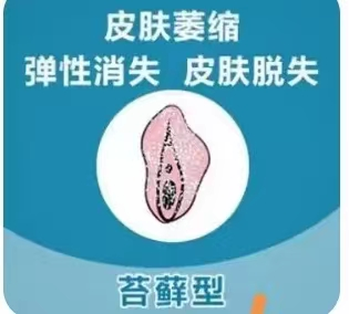 长期瘙痒背后的真相：外阴白斑病患者的心路历程