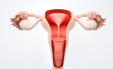子宫腺肌瘤卵巢囊肿是什么原因导致的