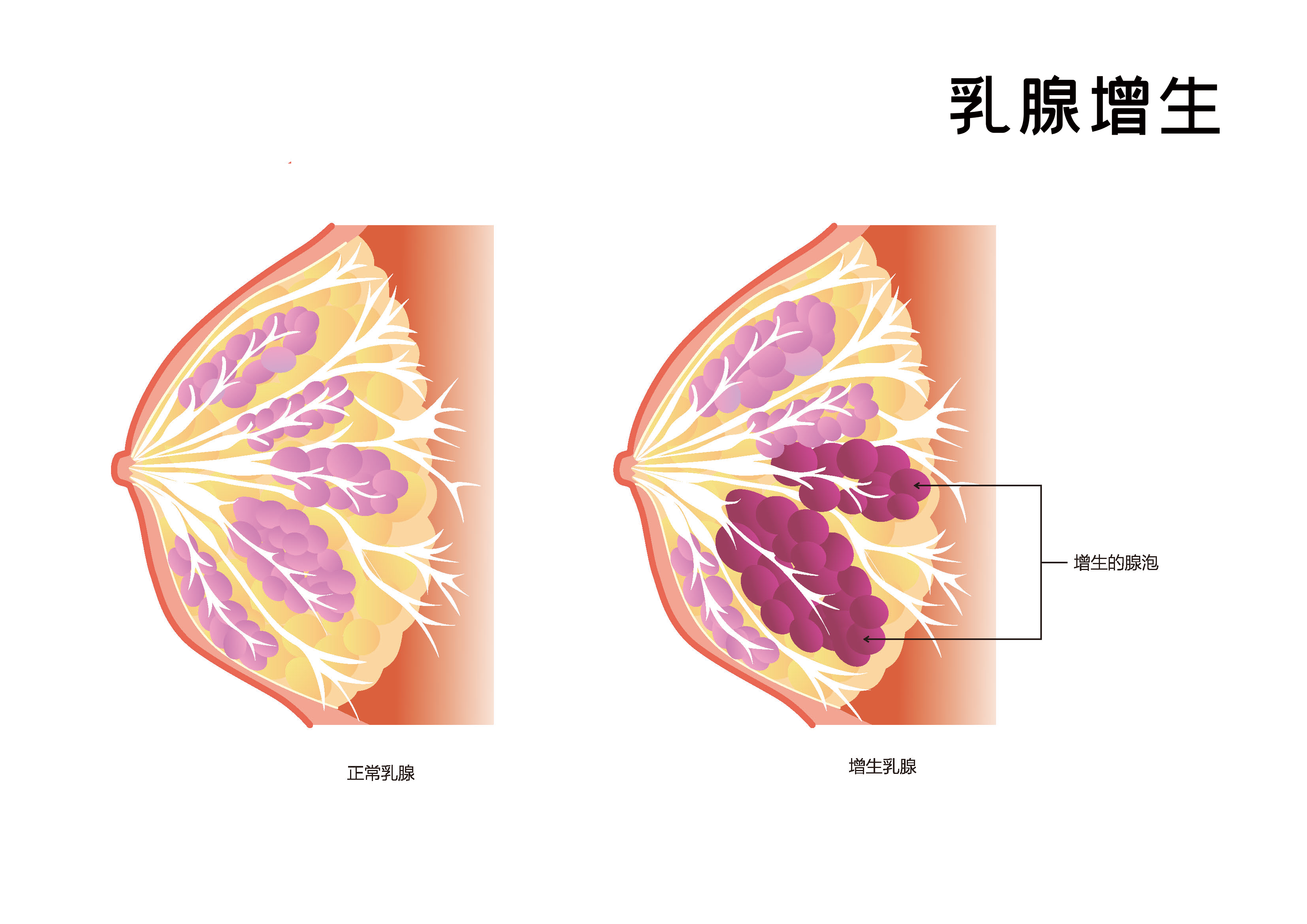 这三种病，真的不用过度治疗