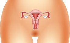 子宫腺肌病和子宫内膜异位症是什么关系？