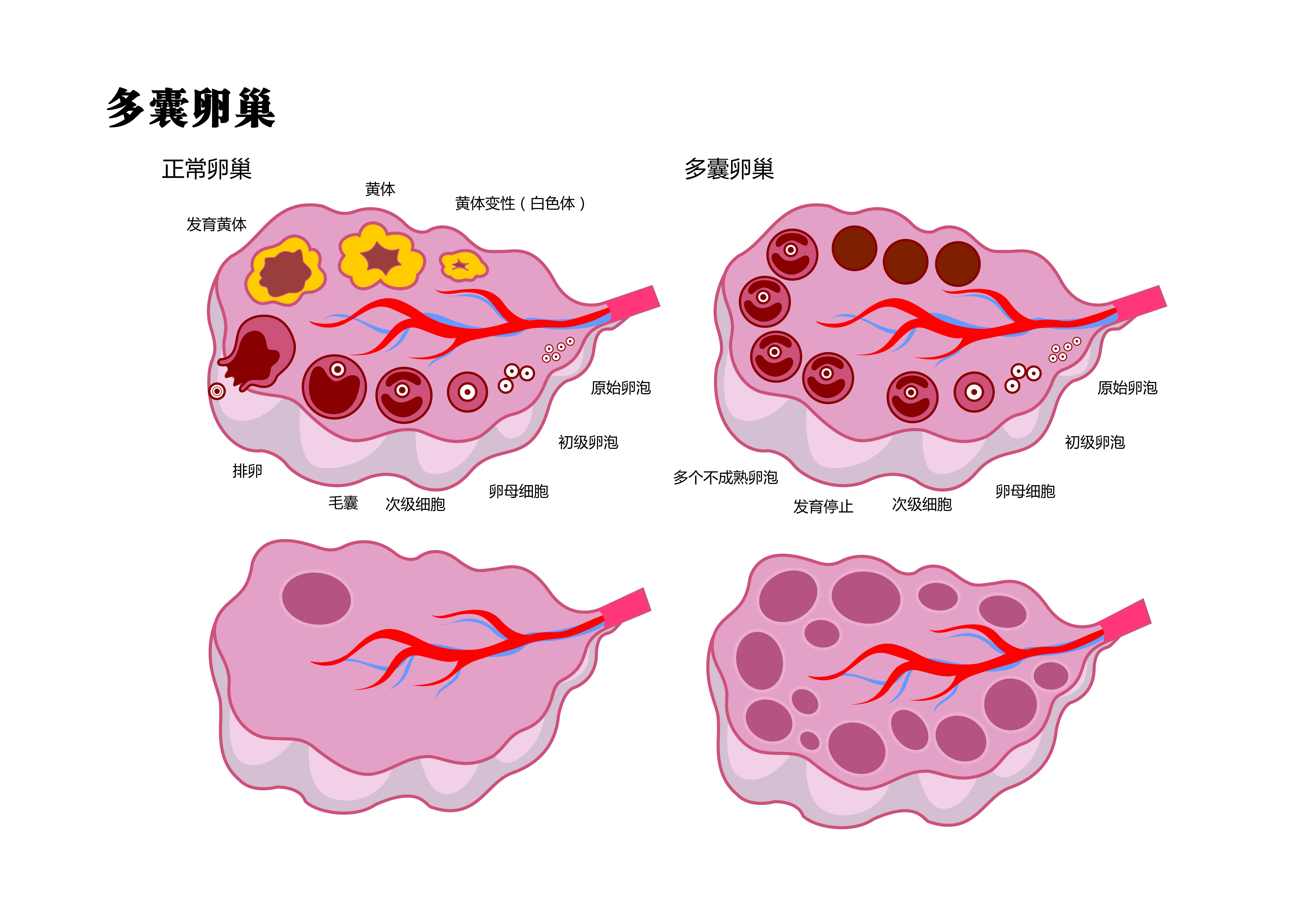 卵巢出了问题月经会变少吗？