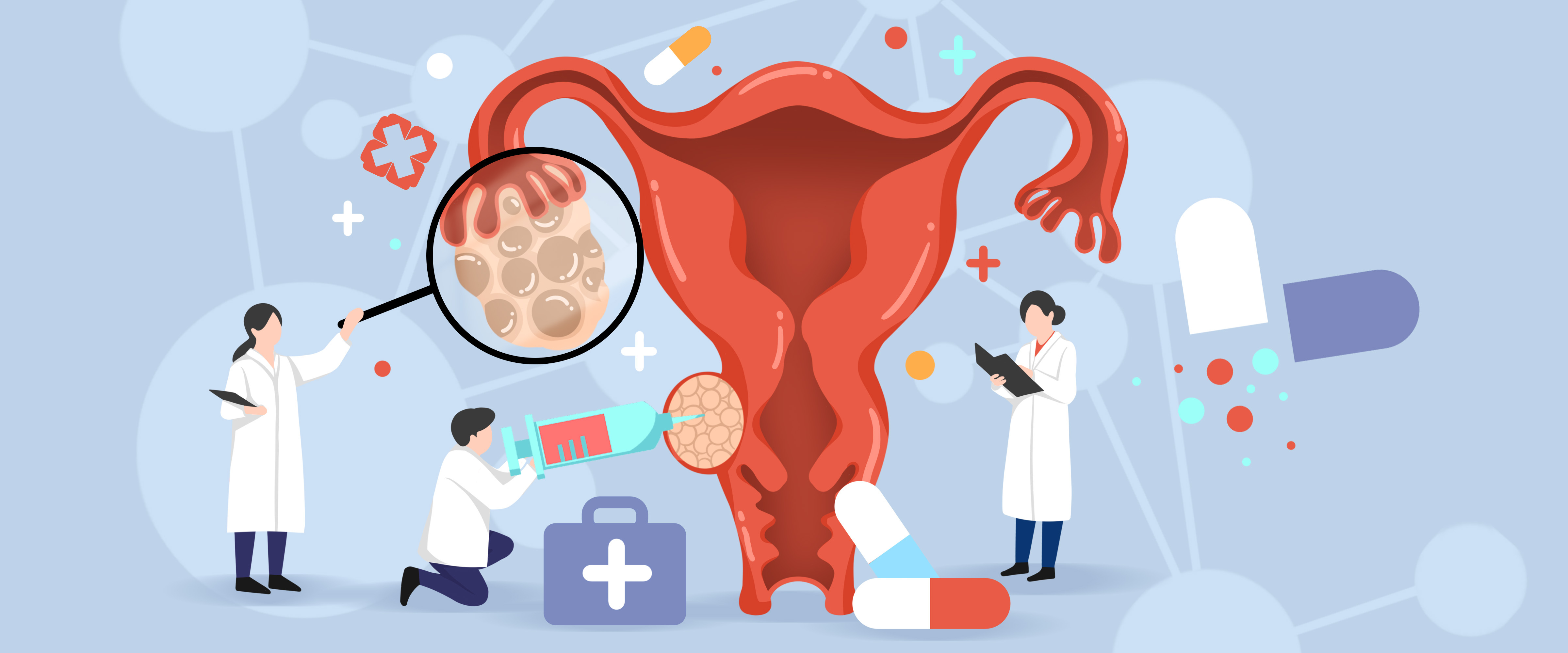 子宫内膜息肉和子宫肌瘤必须分开做手术吗