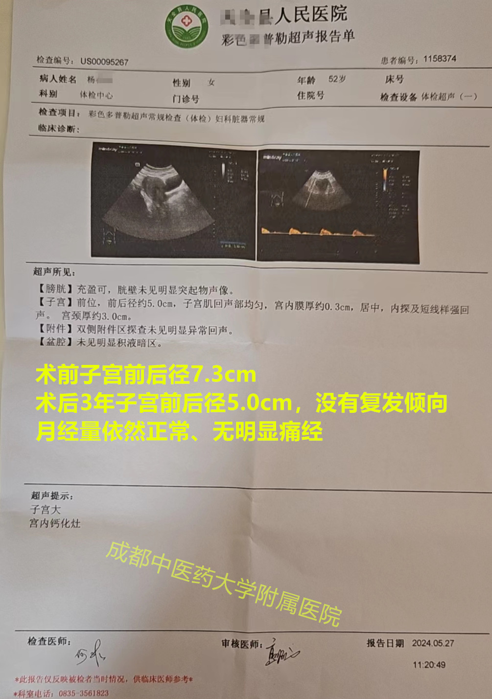 忍痛十年医生还建议切除子宫，非要抗争到底