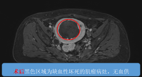 心思费尽寻“解药” 六院海扶献“良方”