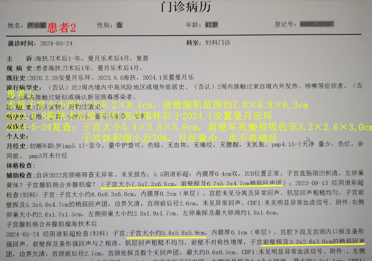 子宫腺肌病，海扶和非海扶治疗效果真的不一样！