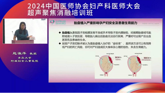 青岛大学附属妇女儿童医院赵淑萍教授：从生育力保护浅谈聚焦超声消融技术