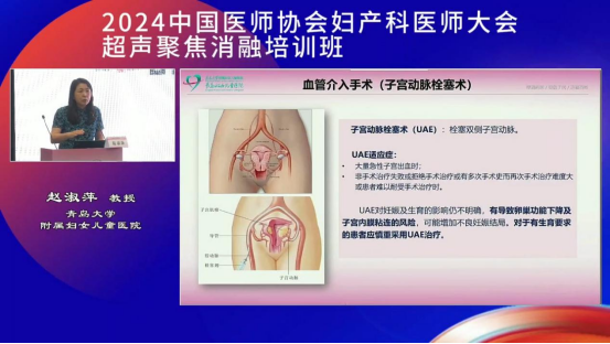 青岛大学附属妇女儿童医院赵淑萍教授：从生育力保护浅谈聚焦超声消融技术