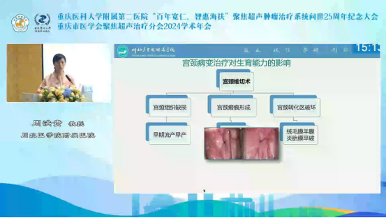 川北医学院附属医院周洪贵：有生育要求患者高危型HPV感染相关HSIL治疗分享