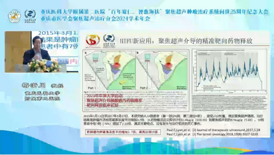 重庆医科大学附属第二医院梅浙川：胰腺癌治疗新前景，聚焦超声技术创新临床应用及实践